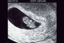 妊娠8週